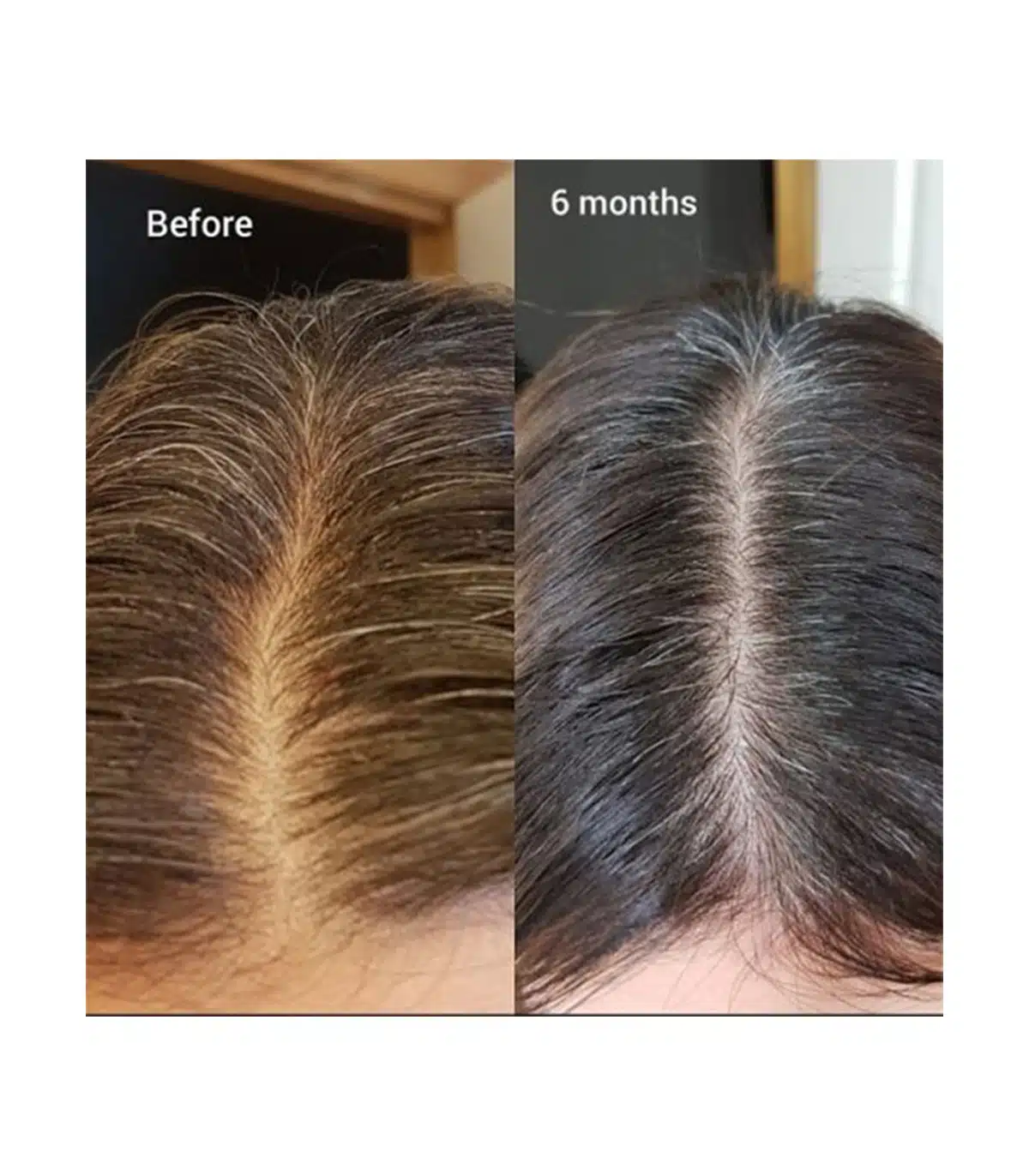 تاثیر سرم مولتی پپتاید اوردینری بر ریزش مو