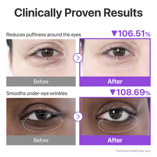 پچ دور چشم نامبوزین Numbuzin مدل NAD+ + 50 Peptides و کلاژن بسته 5 تایی