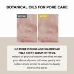 روغن پاک کننده ماداگاسکار سنتلا skin 1004